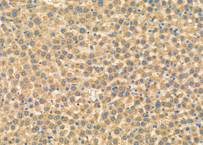 PPA1 Antibody in Immunohistochemistry (Paraffin) (IHC (P))