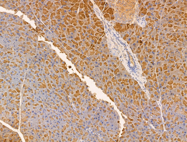 PF4 Antibody in Immunohistochemistry (Paraffin) (IHC (P))