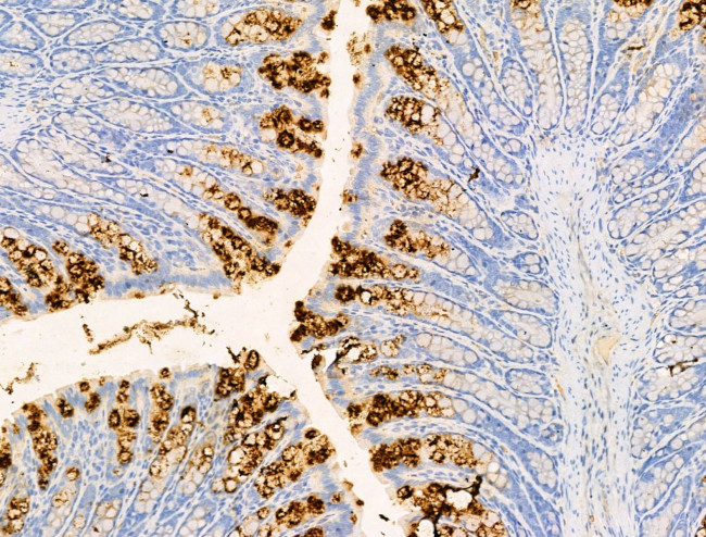 PF4 Antibody in Immunohistochemistry (Paraffin) (IHC (P))