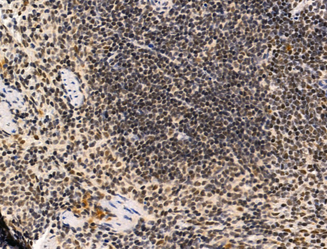 PPP1R2 Antibody in Immunohistochemistry (Paraffin) (IHC (P))