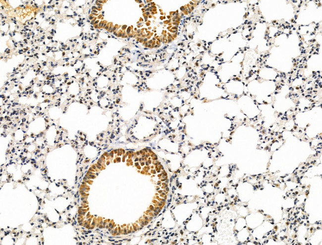 PPP1R2 Antibody in Immunohistochemistry (Paraffin) (IHC (P))