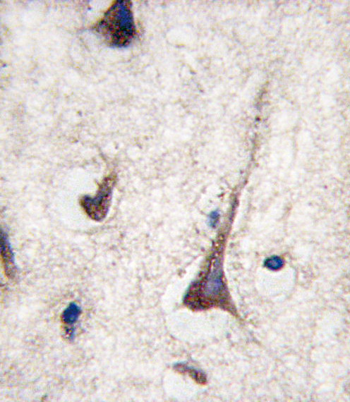 CD3g Antibody in Immunohistochemistry (Paraffin) (IHC (P))