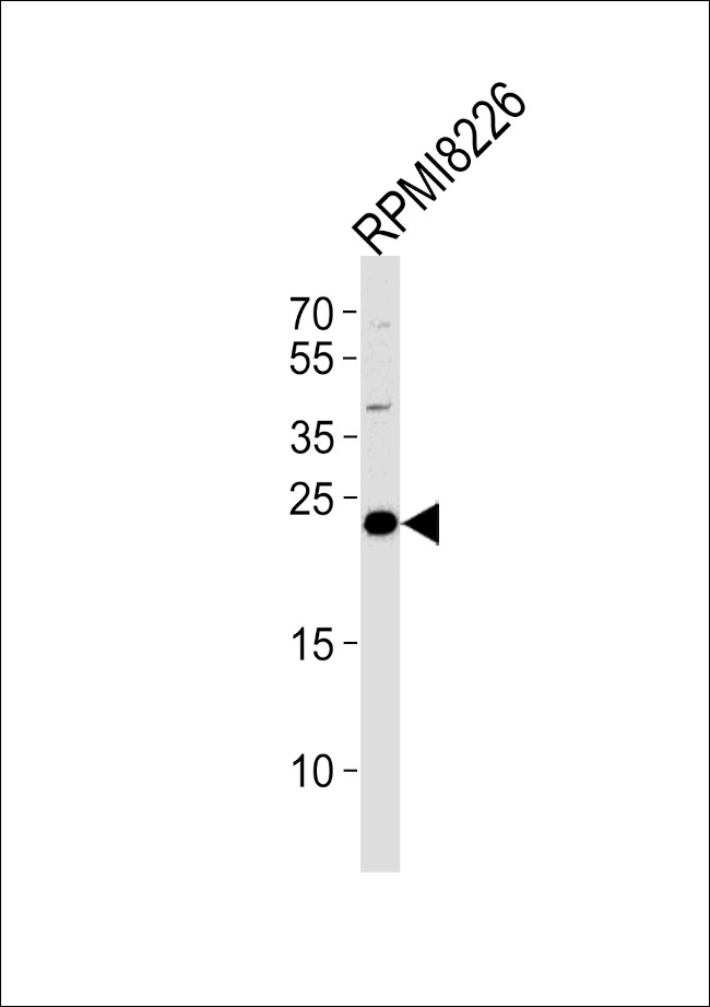 CD3g Antibody in Western Blot (WB)