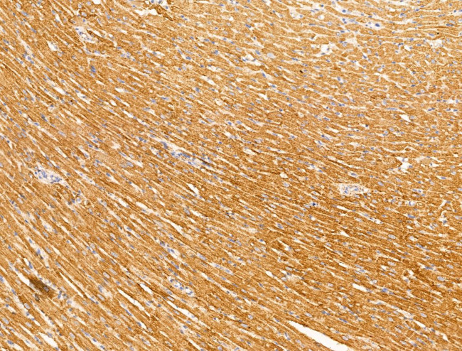 PR3 Antibody in Immunohistochemistry (Paraffin) (IHC (P))