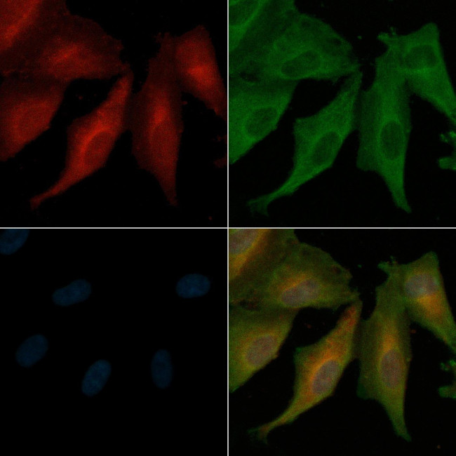 PSEN2 Antibody in Immunocytochemistry (ICC/IF)