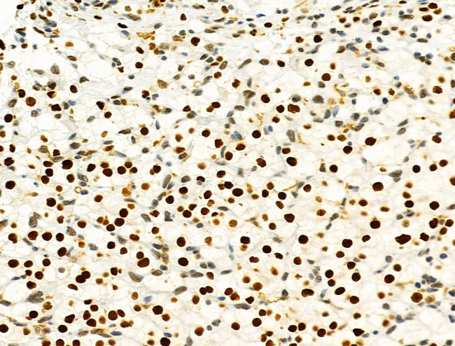 PRMT5 Antibody in Immunohistochemistry (Paraffin) (IHC (P))