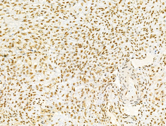 PRMT5 Antibody in Immunohistochemistry (Paraffin) (IHC (P))