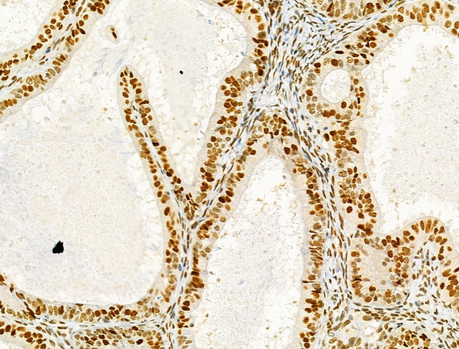 PRMT5 Antibody in Immunohistochemistry (Paraffin) (IHC (P))