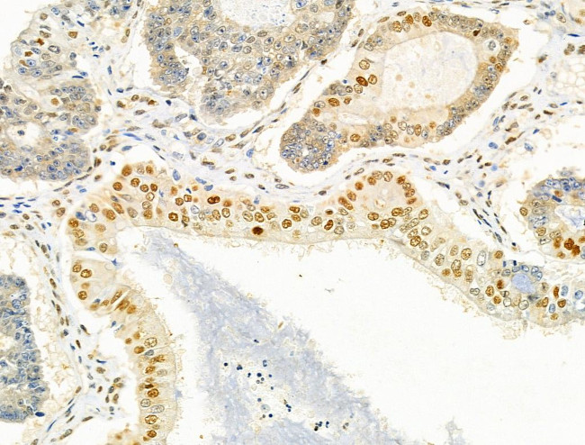 PRMT5 Antibody in Immunohistochemistry (Paraffin) (IHC (P))