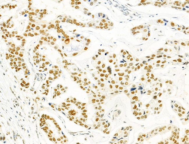 PRMT5 Antibody in Immunohistochemistry (Paraffin) (IHC (P))