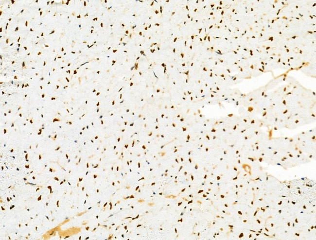 PRMT5 Antibody in Immunohistochemistry (Paraffin) (IHC (P))