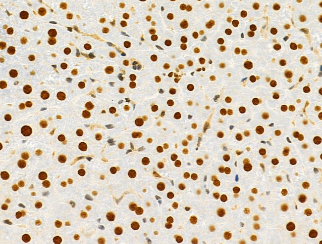 PRMT5 Antibody in Immunohistochemistry (Paraffin) (IHC (P))