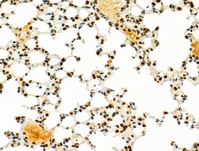 PRMT5 Antibody in Immunohistochemistry (Paraffin) (IHC (P))