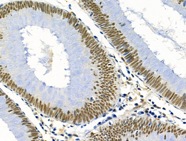 PRMT5 Antibody in Immunohistochemistry (Paraffin) (IHC (P))