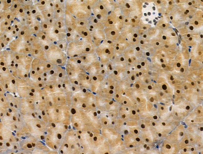 PRMT5 Antibody in Immunohistochemistry (Paraffin) (IHC (P))