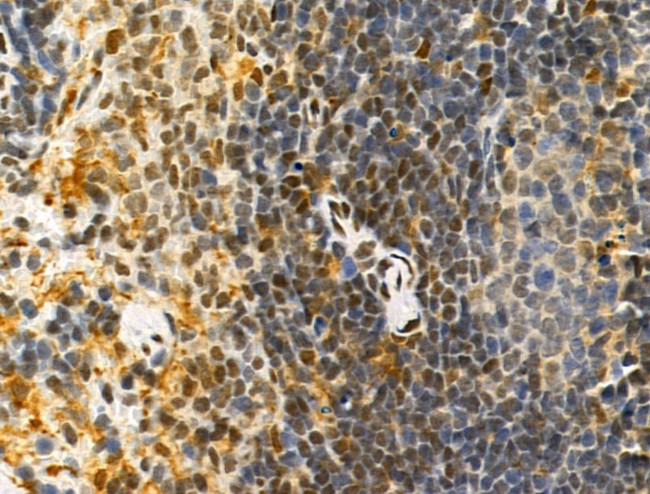 PRMT5 Antibody in Immunohistochemistry (Paraffin) (IHC (P))