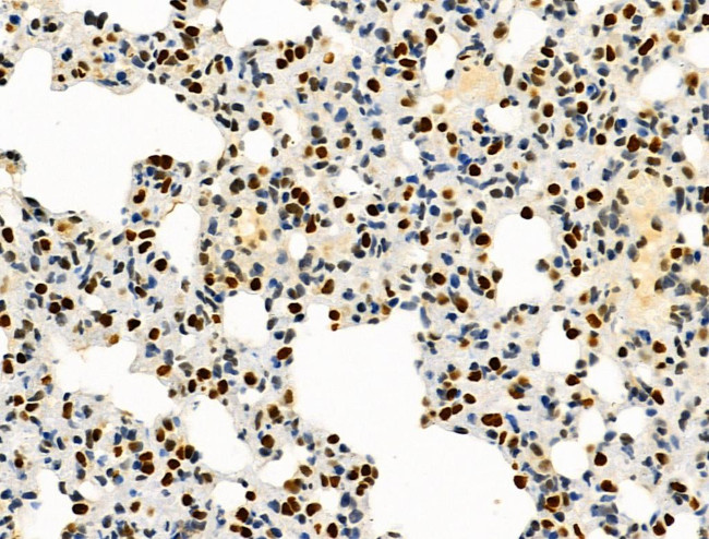 PRMT5 Antibody in Immunohistochemistry (Paraffin) (IHC (P))