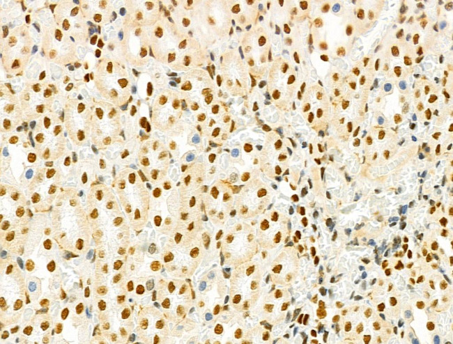 PRMT5 Antibody in Immunohistochemistry (Paraffin) (IHC (P))