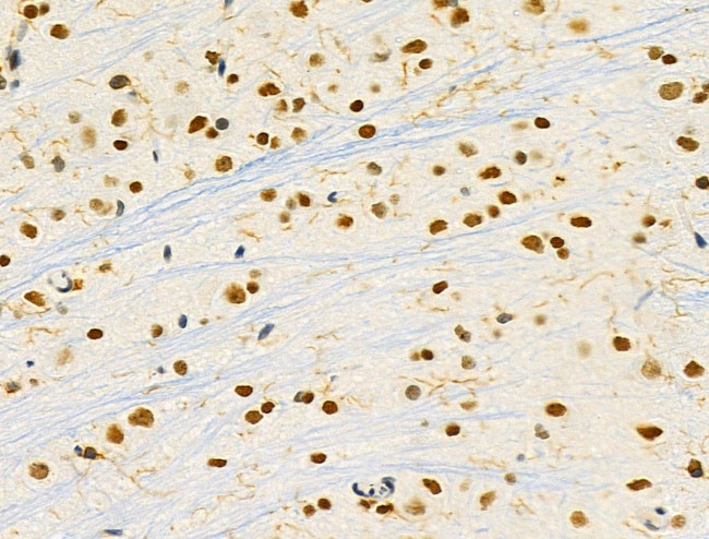 PRMT5 Antibody in Immunohistochemistry (Paraffin) (IHC (P))