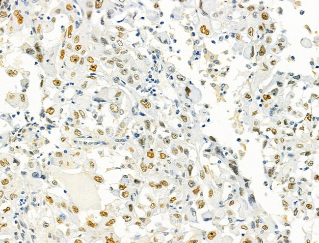 PRMT5 Antibody in Immunohistochemistry (Paraffin) (IHC (P))