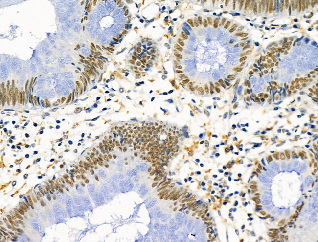 PRMT5 Antibody in Immunohistochemistry (Paraffin) (IHC (P))