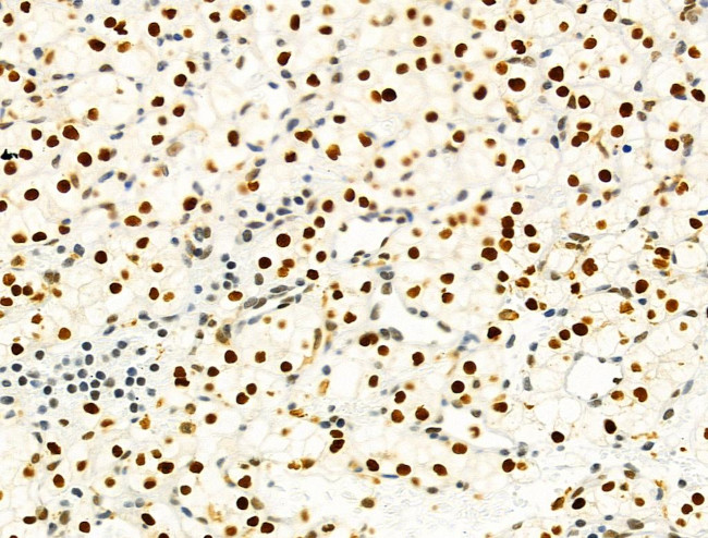 PRMT5 Antibody in Immunohistochemistry (Paraffin) (IHC (P))