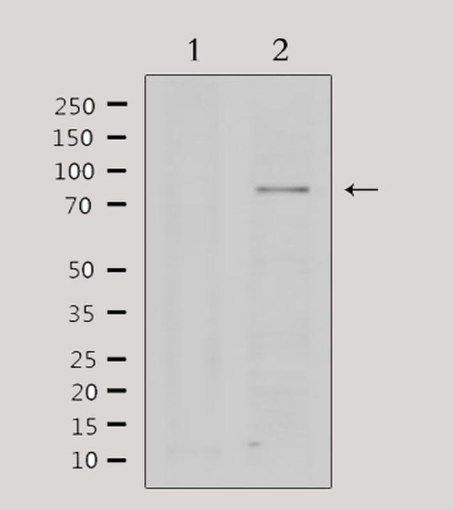 PRMT5 Antibody in Western Blot (WB)