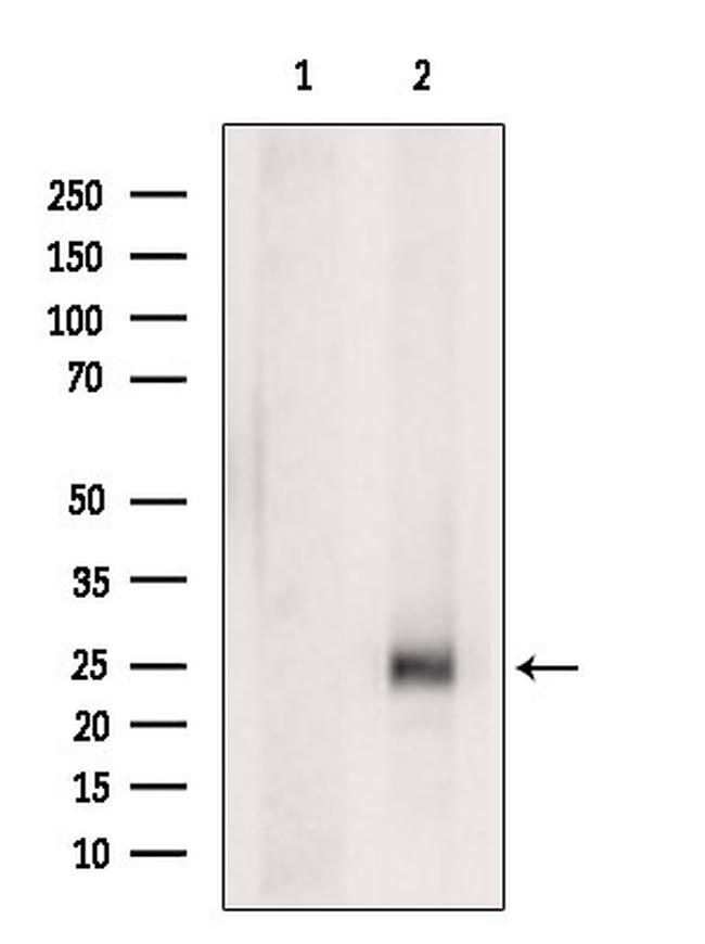 PSCA Antibody in Western Blot (WB)