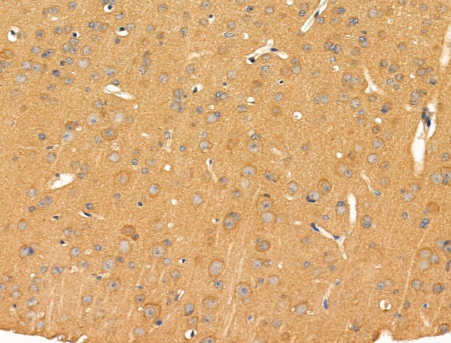 PRRG4 Antibody in Immunohistochemistry (Paraffin) (IHC (P))