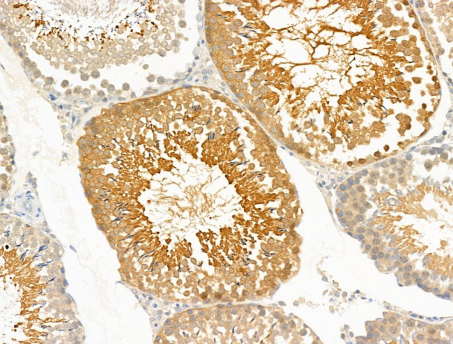 PRRG4 Antibody in Immunohistochemistry (Paraffin) (IHC (P))