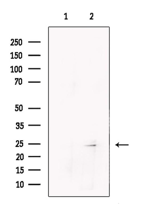 PRRG4 Antibody in Western Blot (WB)