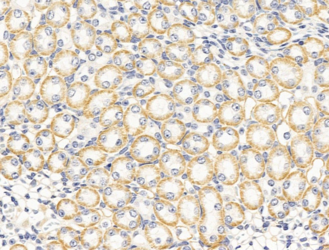 PTCH2 Antibody in Immunohistochemistry (Paraffin) (IHC (P))