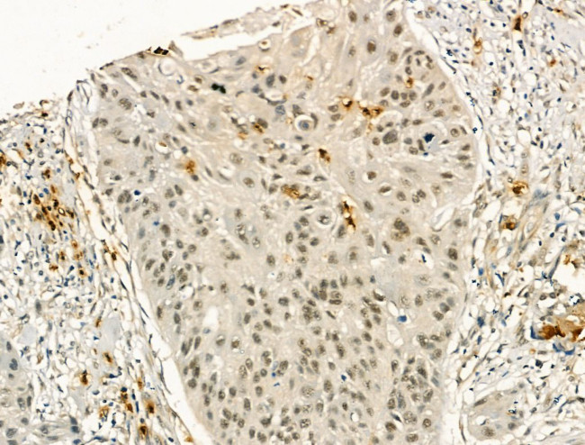 PU.1 Antibody in Immunohistochemistry (Paraffin) (IHC (P))