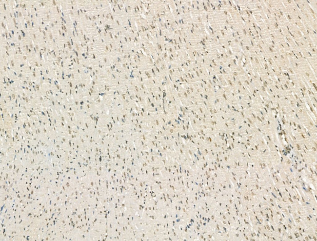 PU.1 Antibody in Immunohistochemistry (Paraffin) (IHC (P))