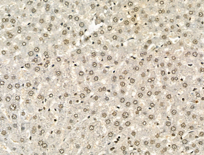 PU.1 Antibody in Immunohistochemistry (Paraffin) (IHC (P))