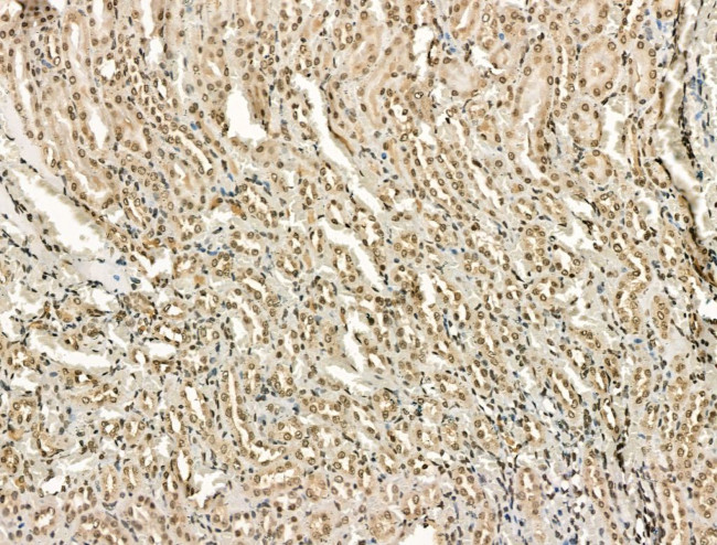 PU.1 Antibody in Immunohistochemistry (Paraffin) (IHC (P))