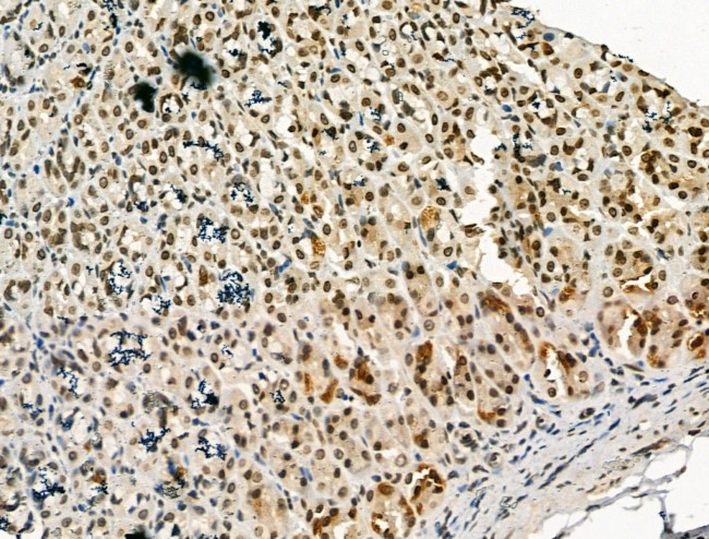 PU.1 Antibody in Immunohistochemistry (Paraffin) (IHC (P))