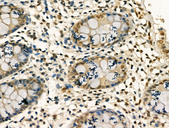 PU.1 Antibody in Immunohistochemistry (Paraffin) (IHC (P))