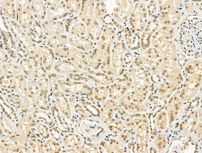 PU.1 Antibody in Immunohistochemistry (Paraffin) (IHC (P))