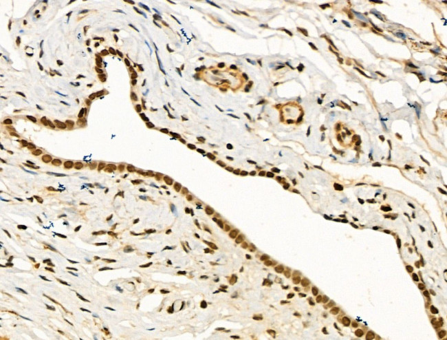 PU.1 Antibody in Immunohistochemistry (Paraffin) (IHC (P))