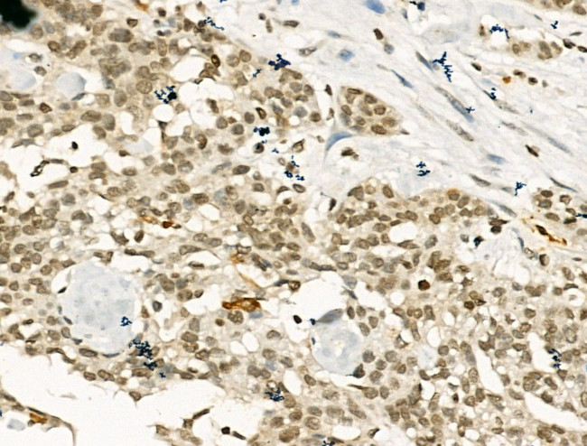 PU.1 Antibody in Immunohistochemistry (Paraffin) (IHC (P))