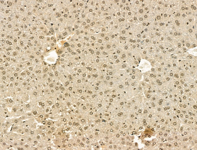 PU.1 Antibody in Immunohistochemistry (Paraffin) (IHC (P))