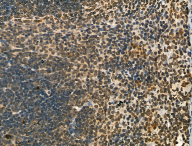 PU.1 Antibody in Immunohistochemistry (Paraffin) (IHC (P))