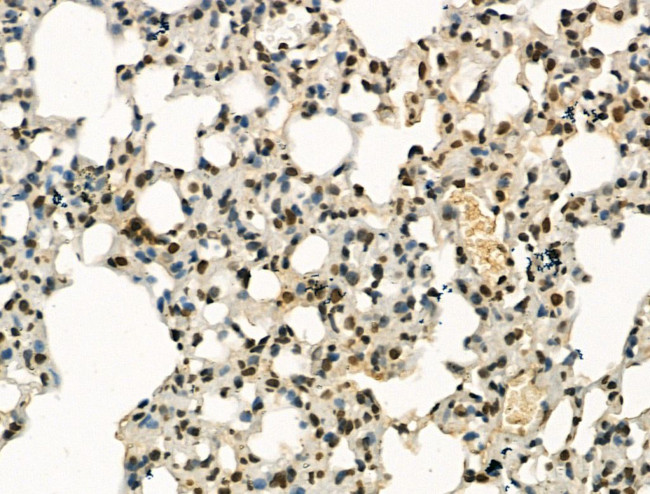 PU.1 Antibody in Immunohistochemistry (Paraffin) (IHC (P))