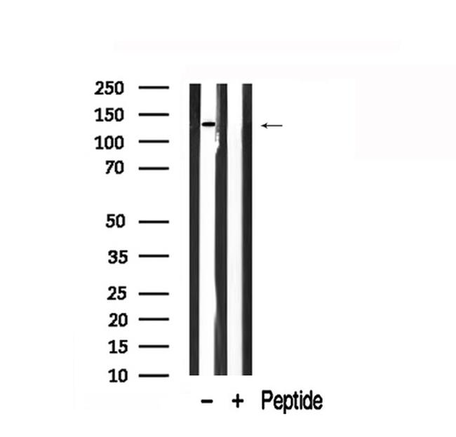 PYK2 Antibody in Western Blot (WB)