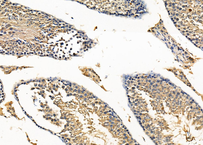 RAB11FIP1 Antibody in Immunohistochemistry (Paraffin) (IHC (P))