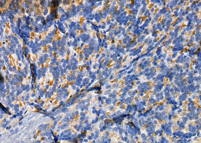 RAB11FIP1 Antibody in Immunohistochemistry (Paraffin) (IHC (P))