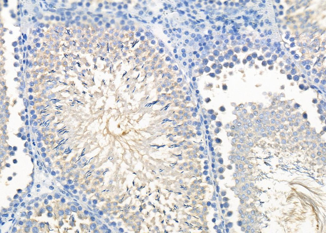 RAB11FIP1 Antibody in Immunohistochemistry (Paraffin) (IHC (P))