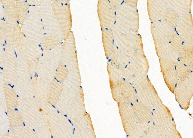 RAB11FIP5 Antibody in Immunohistochemistry (Paraffin) (IHC (P))