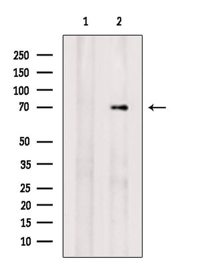 RAB11FIP5 Antibody in Western Blot (WB)